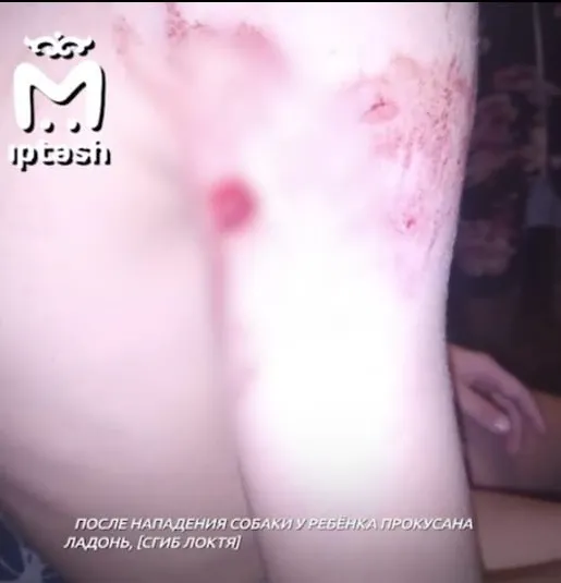В Татарстане лайка напала на 11-летнего мальчика, который еле убежал от собаки
