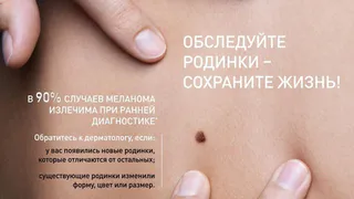 Нижнекамска приглашают на бесплатную диагностику родинок
