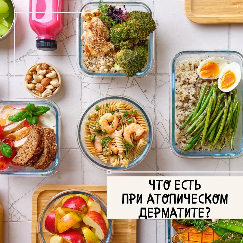 Что есть при атопическом дерматите?