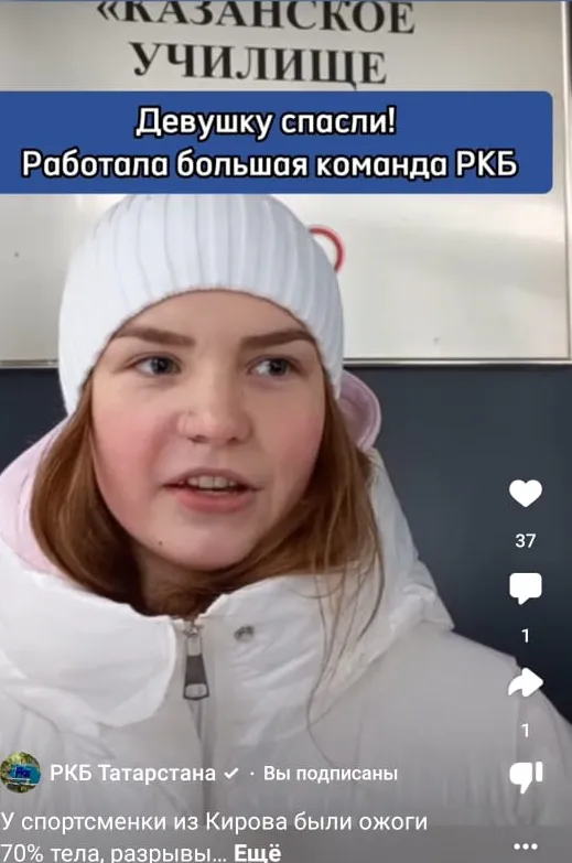 Чудеса: в Татарстане спасли девушку с 70 % ожогов тела