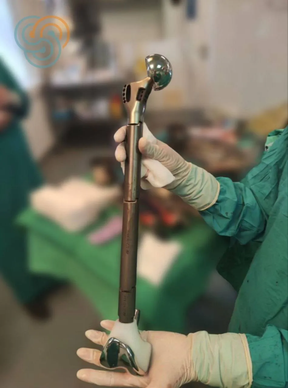 В Татарстане провели уникальную операцию — пациентке сохранили ногу при саркоме бедренной кости